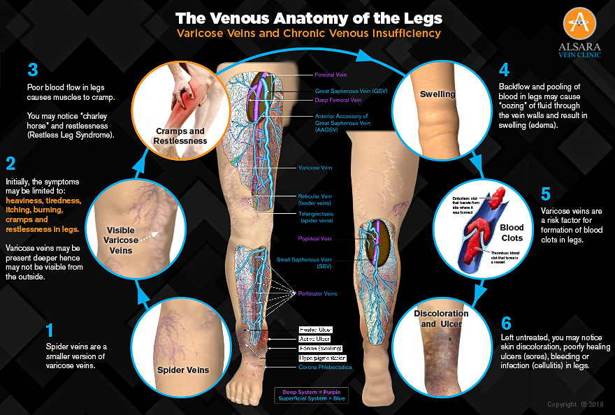 venous anatomy of the legs