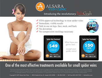 veingogh spider vein treatment