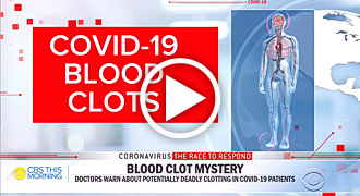 COVID-19 Blood Clots